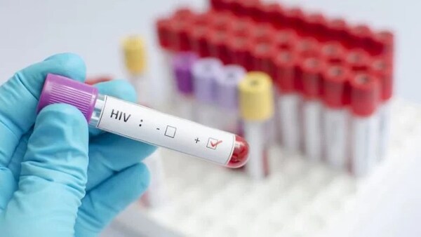 PARAGUAY REGISTRA PROGRESIVO INCREMENTO DE NUEVOS CASOS DE VIH