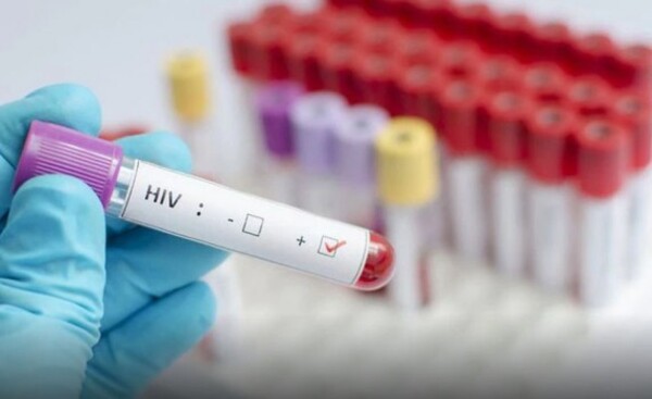 Paraguay registra progresivo incremento de nuevos casos de VIH