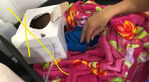Bebé prematuro recibió oxigeno usando como soporte una caja de cartón por falta de terapia - Noticiero Paraguay