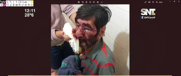 Canindeyú: Golpeo brutalmente a su padre - SNT