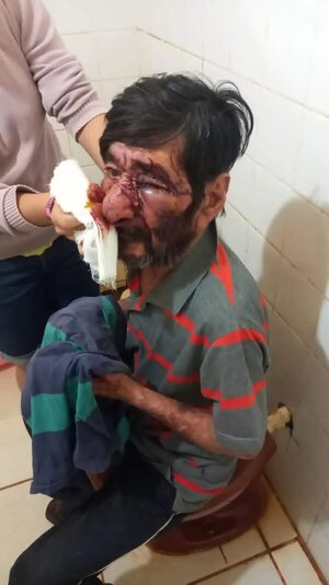 Septuagenario fue agredido brutalmente por su hijo - Policiales - ABC Color