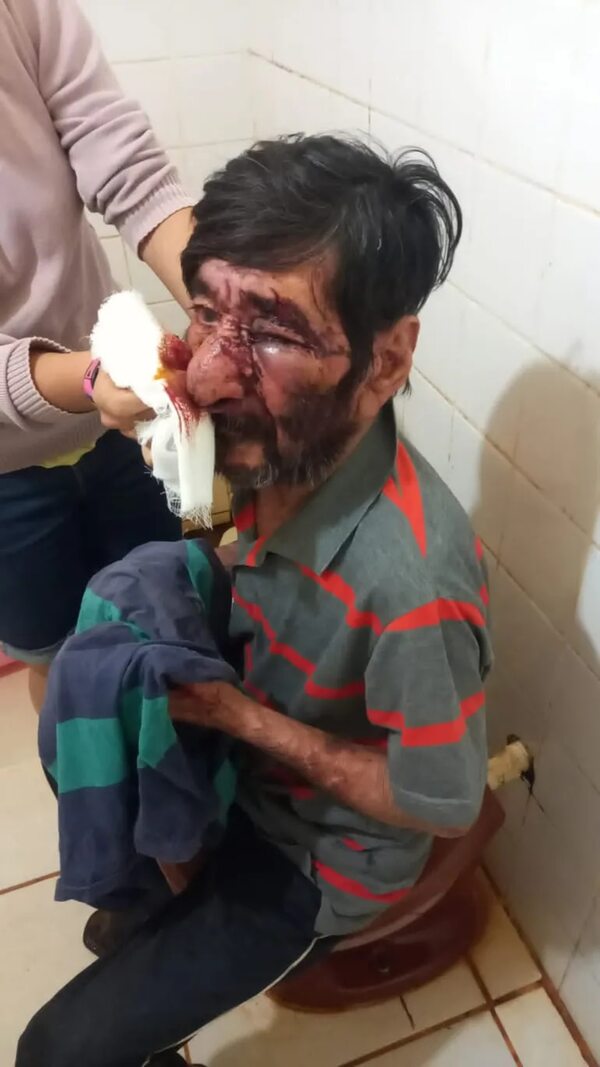 Septuagenario fue agredido brutalmente por su hijo - Policiales - ABC Color