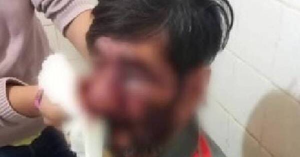 La Nación / Detienen a un hombre que golpeó brutalmente a su padre en Cainindeyú