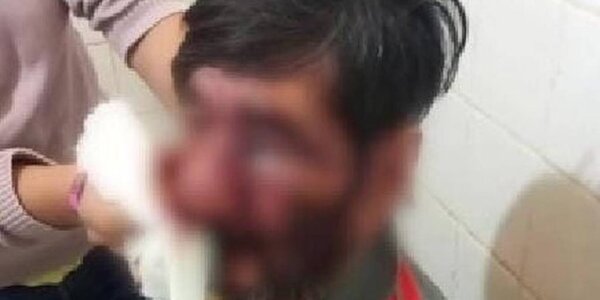 Detienen a un hombre que golpeó brutalmente a su padre en Cainindeyú