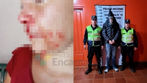 Mayor Otaño: Capturan a hombre que sup. agredió brutalmente a su expareja