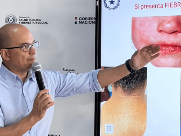 Vacuna hexavalente se incorpora en salud pública para evitar las múltiples inyecciones · Radio Monumental 1080 AM
