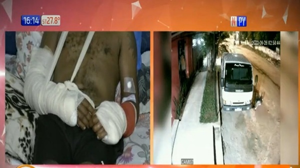 Víctima de brutal macheteada pide justicia - Noticias Paraguay