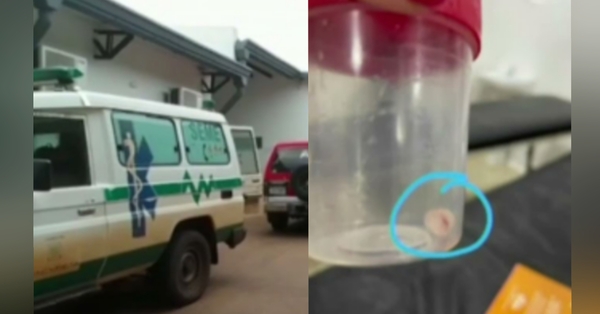 Salvan a niña que tenía una tapa de dentrífico alojada en las vías respiratorias