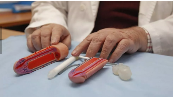 Médicos preocupados por falsas publicidades de agrandamiento del “amiguito”