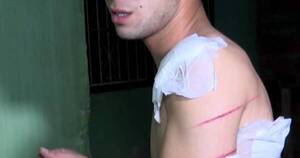 La Nación / San Lorenzo: joven que fue macheteado por su cuñado, teme por su vida y pide protección