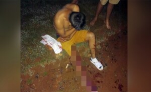 Joven fue herido en la pierna en un asentamiento esteño