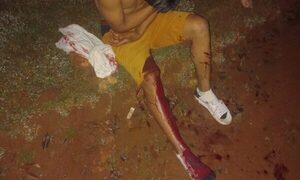 Balean a joven en Minga Guazú