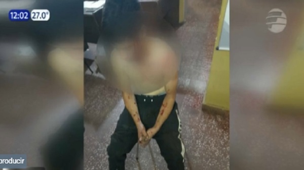 Hombre resultó macheteado en disputa familiar - Noticias Paraguay