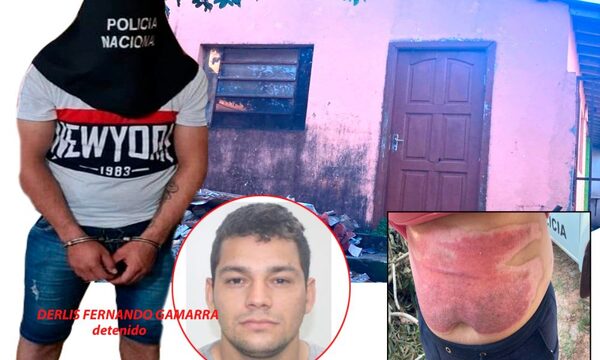Detienen a violento sujeto que había prendido fuego por su concubina en barrio San Juan – Diario TNPRESS