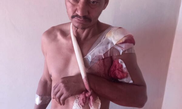 Estaba tomando con su amigo y se les disparó una escopeta que manipulaban – Diario TNPRESS