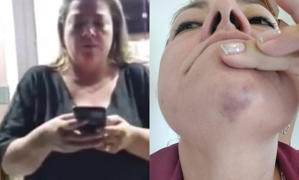 Diario HOY | Escrache y agresión a senadora: "Niña vio cómo intentaron matar a su mamá"