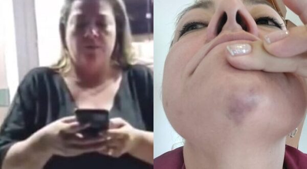 Senadora de Cruzada Nacional es agredida brutalmente por su expareja por apoyar a “Beto” Ovelar