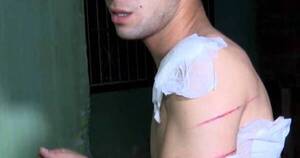 La Nación / Joven herido teme y pide protección