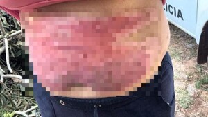 Encerró a su expareja e intentó estrangularla