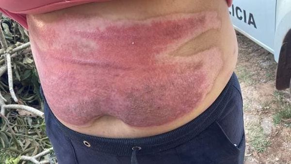 MESES ATRÁS INTENTÓ QUEMAR VIVA A LA VÍCTIMA - La Voz del Norte