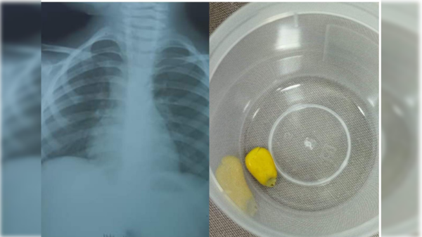 Nenita de 3 añitos daba de comer a las gallinas y ¡casi muere por una razón inesperada!