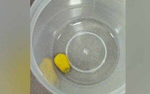Grano de maíz obstruía vía respiratoria de niña de 3 años – Prensa 5