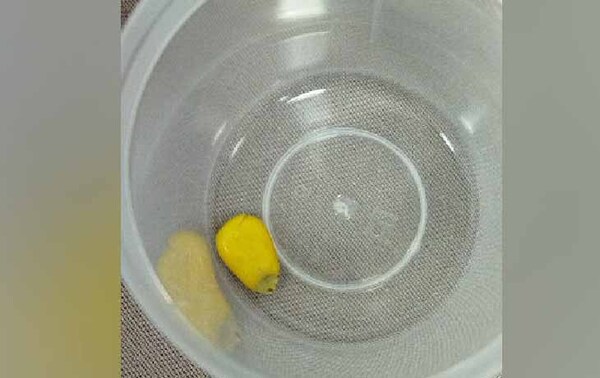 Grano de maíz obstruía vía respiratoria de niña de 3 años – Prensa 5