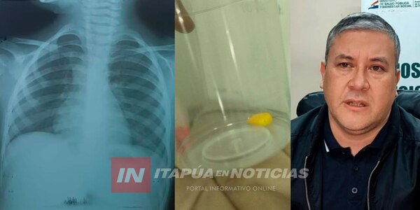 MÉDICOS SALVARON VIDA DE NIÑA QUE SE ATRAGANTÓ CON UN MAÍZ EN EL HOSPITAL REGIONAL - Itapúa Noticias