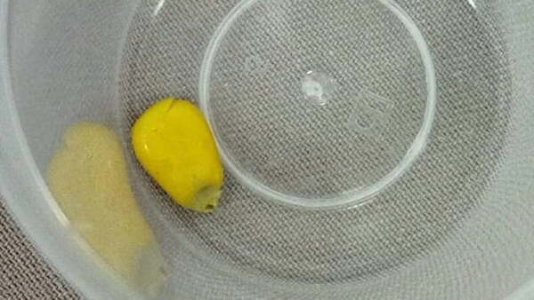 Salvan a niña de 3 años que aspiró un grano de maíz en Encarnación - Noticiero Paraguay