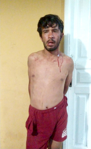 Sangrienta pelea entre adictos en el mercado de CDE deja un herido grave - La Clave
