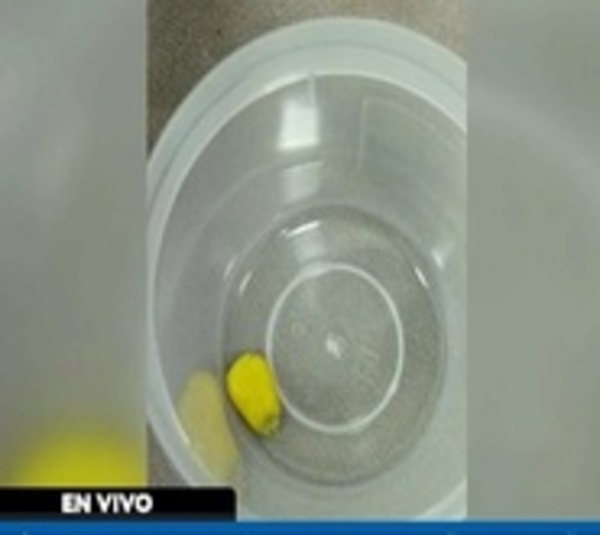 Niña de 3 años aspiró un grano de maíz y casi pierde la vida - Paraguay.com