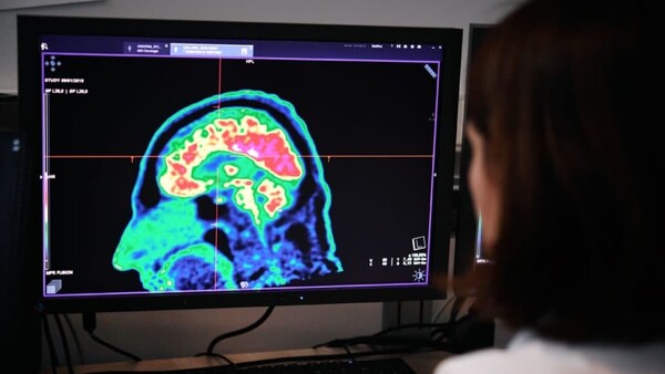 EEUU amplía el acceso a un nuevo tratamiento contra el alzhéimer