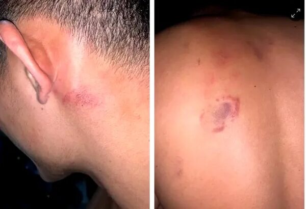 Paraguayo detenido en España denuncia haber sido agredido por policías - Nacionales - ABC Color