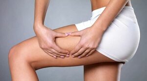 Los 18 mejores ejercicios para combatir la celulitis y lucir piernas de infarto