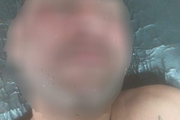 Sufrió un accidente y quedó detenido por poseer orden de captura