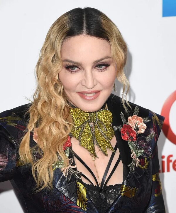 Madonna dice estar recuperándose y agradece el cariño de sus fans - Música - ABC Color