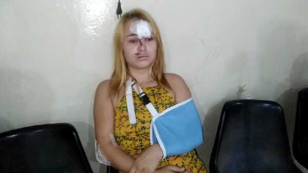 Caballo suelto pateó en la cara a una motociclista
