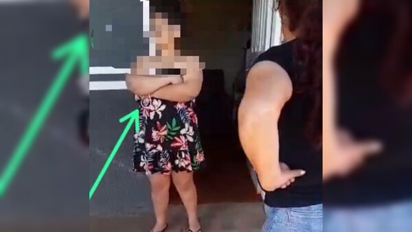 Adolescente golpeó brutalmente a su novia en Pedro Juan