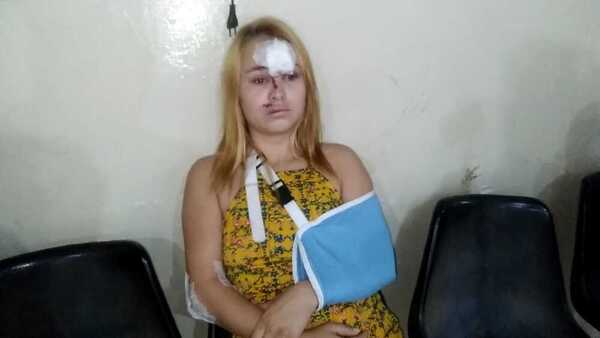 Caballo suelto patea a una joven a bordo de una motocicleta