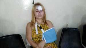 Caballo suelto patea a una joven en la cara