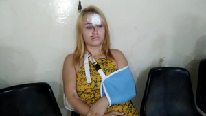 Joven fue pateada en la cara por un caballo suelto - Noticiero Paraguay