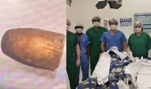 Sacaron proyectil de la cabeza de niña que recibió bala perdida - Noticiero Paraguay