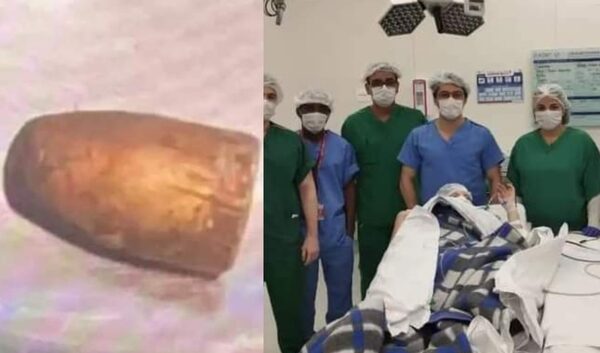Sacaron proyectil de la cabeza de niña que recibió bala perdida - Noticiero Paraguay