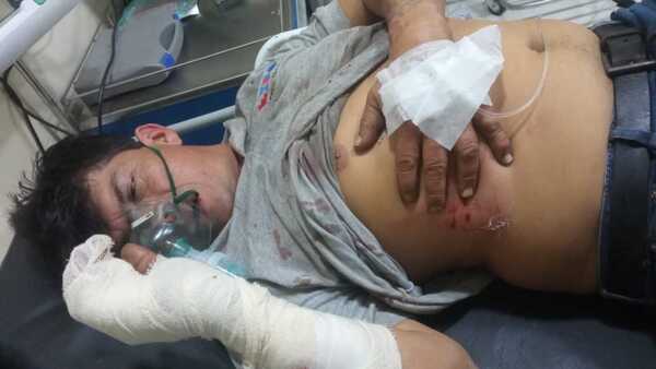 Golpeó portón ajeno sin querer y le garrotearon, denunció