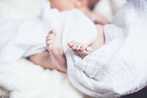 Diario HOY | Bebés siameses nacidos en Clínicas, con pronóstico reservado