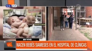 Nacen bebés siameses en el hospital de Clínicas | Telefuturo