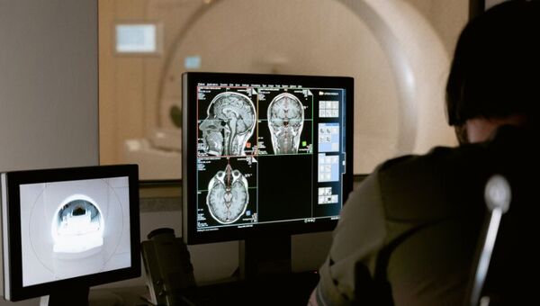 La FDA aprobó por primera vez un medicamento que ralentiza la progresión del Alzheimer