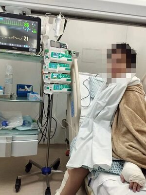 Caso adolescente con bala alojada en el cráneo: cirugía de extracción de proyectil fue exitosa - Policiales - ABC Color