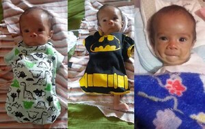 Niño que nació sin brazos y con solo una pierna necesita ayuda para someterse a un tratamiento – Prensa 5