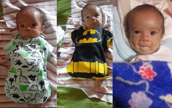 Niño que nació sin brazos y con solo una pierna necesita ayuda para someterse a un tratamiento – Prensa 5